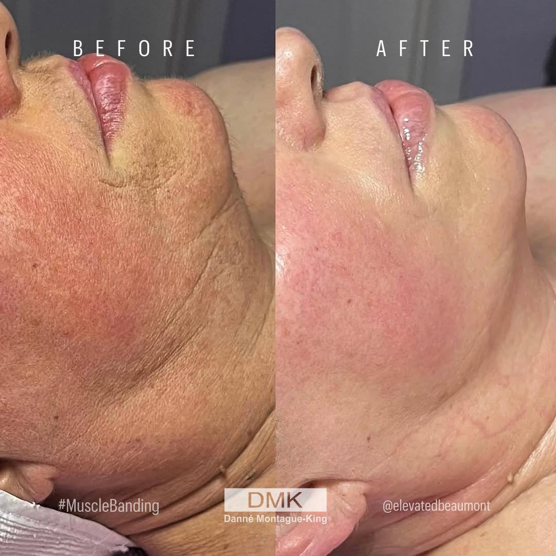 💚 DMK International | Professional Skincare 💚 tweet media