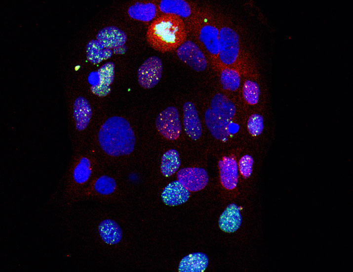 Science Signaling (@scisignal) on Twitter photo Colorectal cancer cells rely on a protein named NEMO to recover from DNA-damaging therapies such as radiation, according to research that suggests NEMO could be a useful #prognostic indicator for treatment responses. <a href="/BigSpinLab/">Bigas/Espinosa Lab</a> <a href="/HMar_research/">HMar Research Institute</a> scim.ag/3Dycgol Colorectal cancer cells rely on a protein named NEMO to recover from DNA-damaging therapies such as radiation, according to research that suggests NEMO could be a useful #prognostic indicator for treatment responses. <a href="/BigSpinLab/">Bigas/Espinosa Lab</a> <a href="/HMar_research/">HMar Research Institute</a> scim.ag/3Dycgol