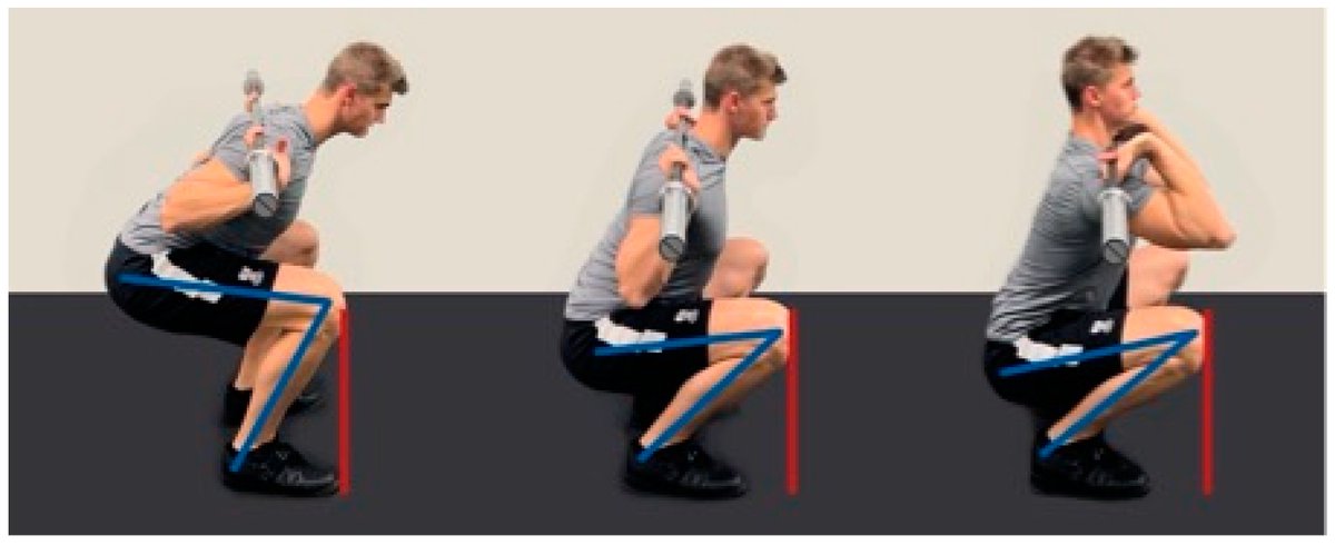 The Limitations of Anterior Knee Displacement during Different Barbell Squat Techniques: A Comprehensive Review

👇👇👇

"Overall, limiting this natural mobility is probably not a good idea for healthy, trained individuals."

mdpi.com/2077-0383/12/8…