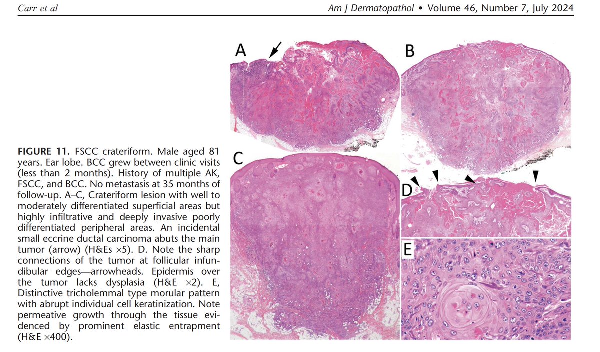 Christine J. Ko, MD tweet media