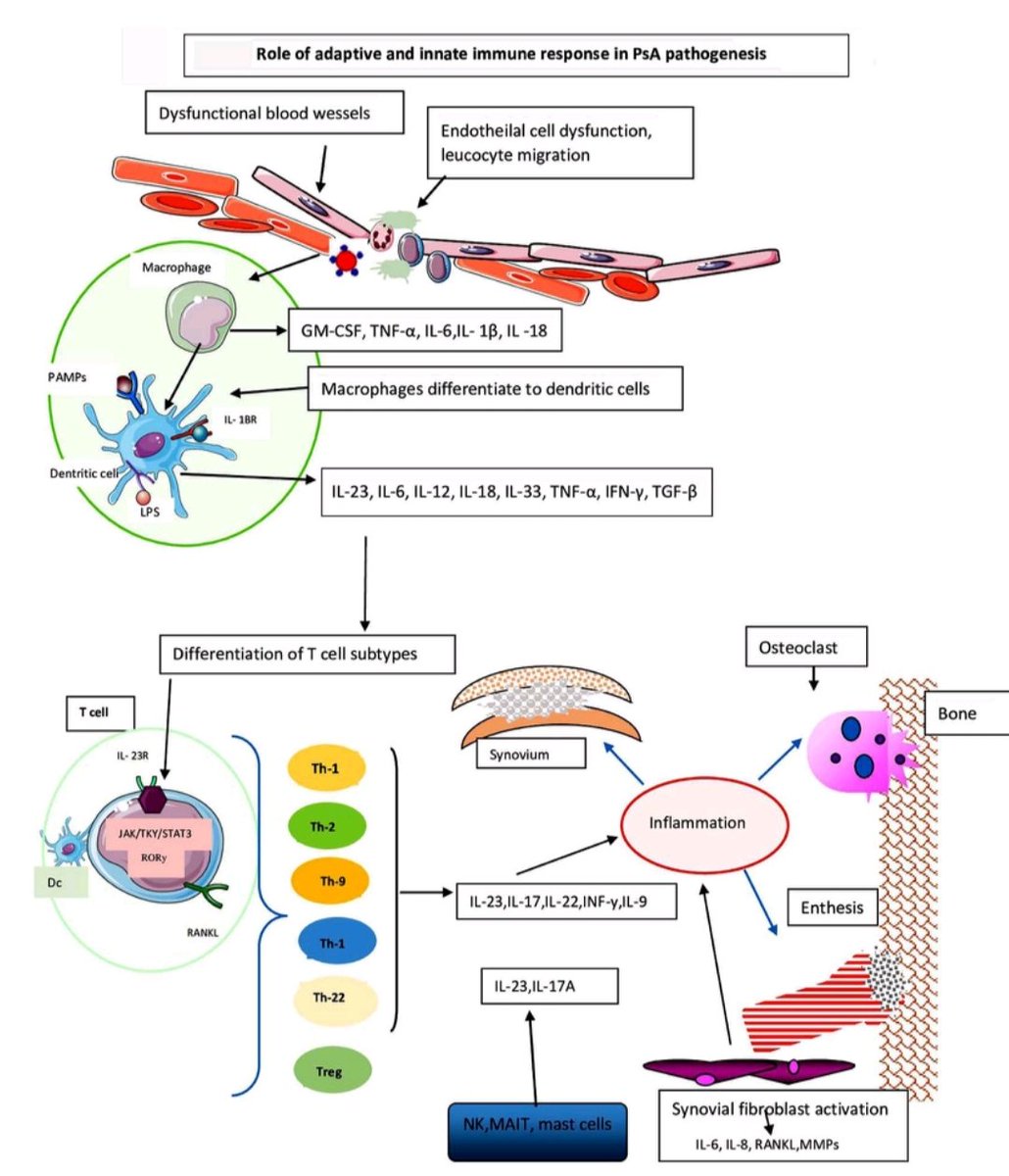 Archives of Rheumatology (@archofrheum) on Twitter photo A primer on immunopathology of PsA👇
archivesofrheumatology.org/full-text/1654
<a href="/UnanMehtap46484/">mehtap unan</a>
<a href="/GencTRASD/">Genç TRASD</a> A primer on immunopathology of PsA👇
archivesofrheumatology.org/full-text/1654
<a href="/UnanMehtap46484/">mehtap unan</a>
<a href="/GencTRASD/">Genç TRASD</a>