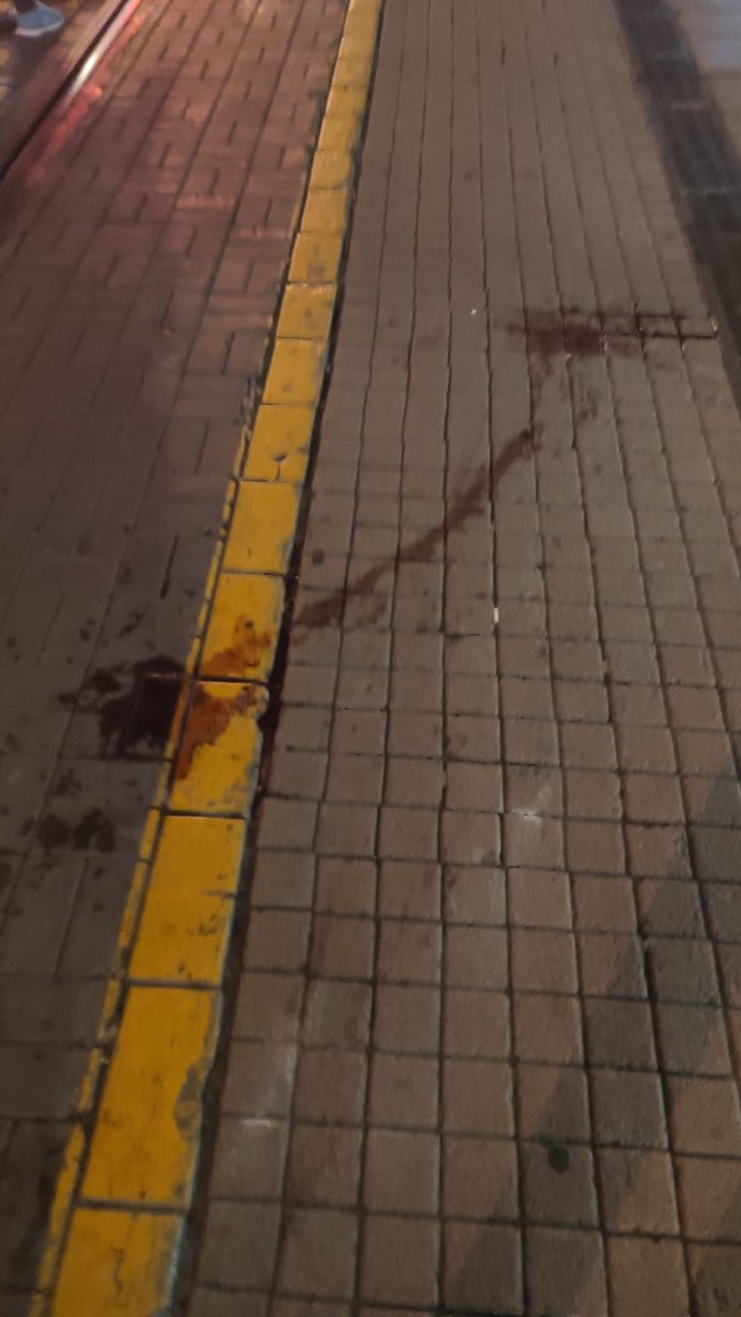 eskişehir
eylemden kaçan birine yapılan "müdahale" nolur çok acil yayalım siyasi destek lazım eskişehire