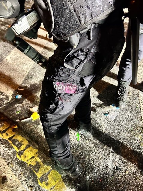 Allah belanızı versin. Polise asit atmak nedir ulan