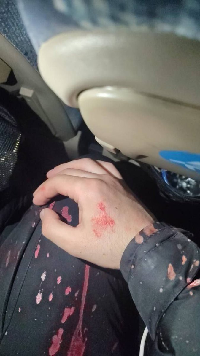 istTakipte's tweet photo. Vatan hainleri! Satılmış oevlatları! 

Polise asit atan adamdan öğrenci olur mu? 

Bunlar terörist! https://t.co/IdG9Nznolq