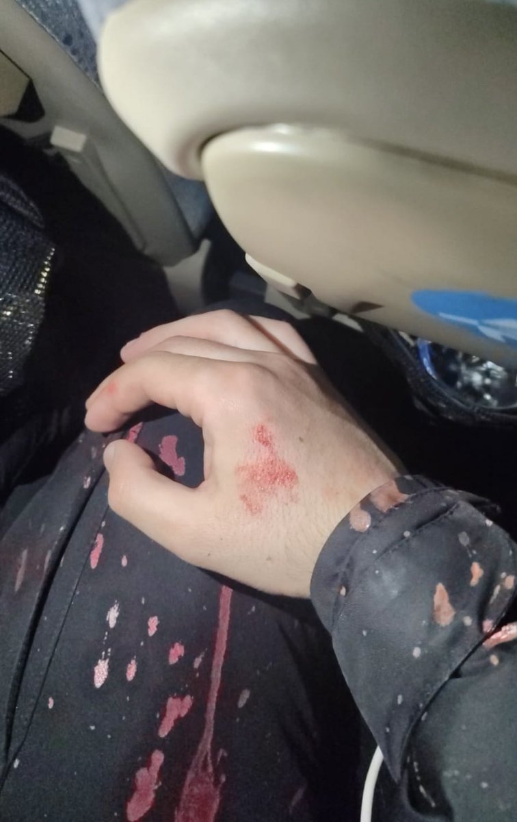 Özgür Özel’in sokağa çağırdığı eylemciler görevi başındaki polis memurlarına asit attı. Bunun hesabı sorulmayacak mı sanıyorsunuz ??