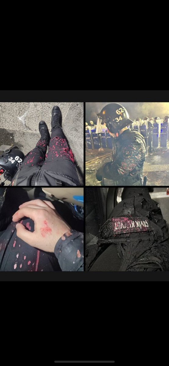 Onlarca yolsuzluğa hırsızlığa karşı çıkıp tepki göstermek yerine tam tersi bunu savunup Türk polisine saldırmak akıl tutulmasıdır. Türkiye bir hukuk devletidir ve kim ne yaptıysa hukuk çerçevesinde cezasını çekmelidir kim olursa olsun bu herkes için eşittir. #tutuklandı