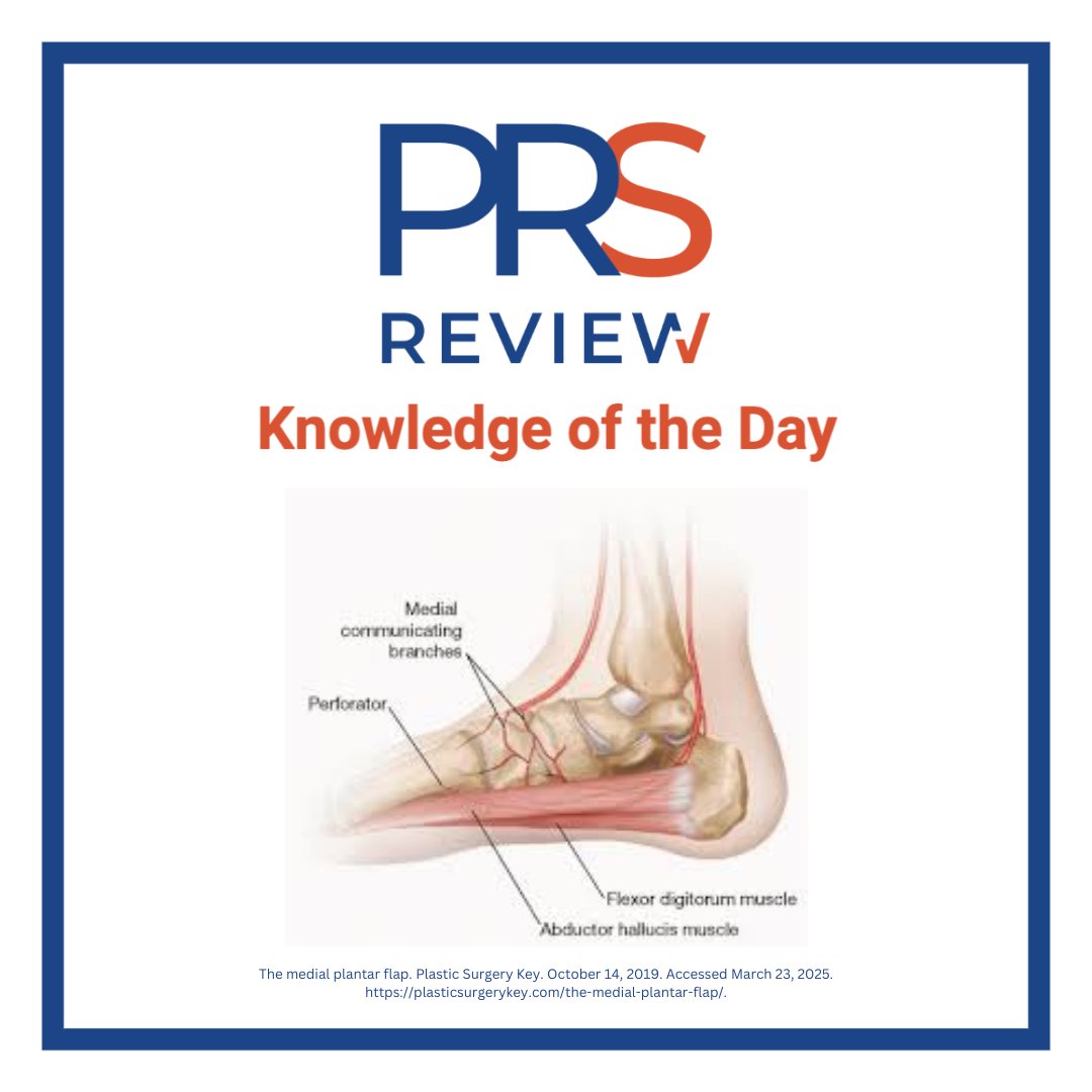 prsreview's tweet photo. Medial plantar artery flap
#prsreview #flap #flapsurgery #microsurgery #heelreconstruction #footwound #wound #woundcoverage #woundhealing #plasticsurgery #reconstructivesurgery #surgicaleducation #medicaleducation #meded #plasticsurgeryresidency #plasticsurgeon #surgery https://t.co/3tehC3KtZy