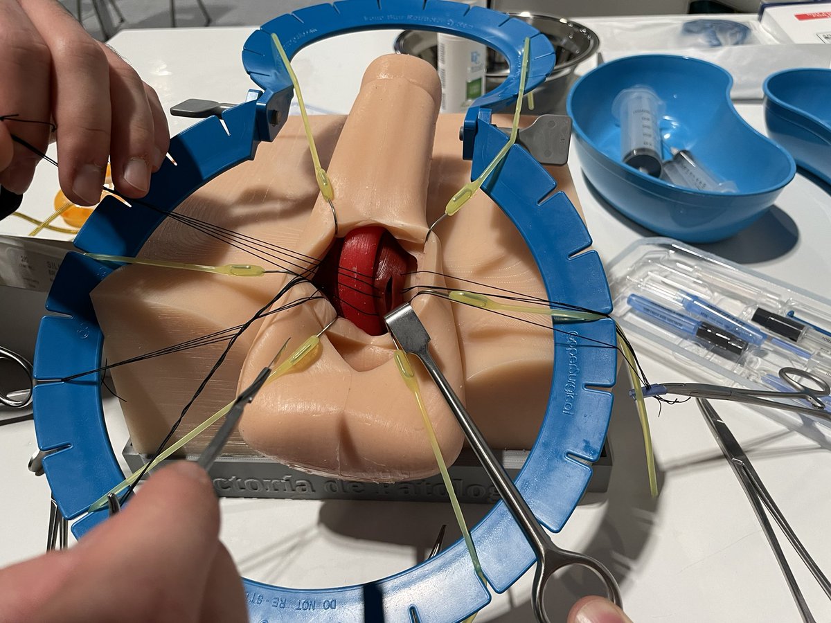 Marta Skrodzka (@skrodzkam) on Twitter photo Great experience to be one of the tutors on the first #EAU25 hands on training course on penile implant insertion. Significant improvements to IPP training coming <a href="/Uroweb/">European Association of Urology (EAU)</a> <a href="/UrowebESU/">European School of Urology (EAU ESU)</a> <a href="/BSCEMEA_Urology/">Boston Scientific EMEA - Urology</a> <a href="/donwglee/">Wai Gin (Don) Lee</a> <a href="/CarloBettocchi/">Prof. Carlo Bettocchi</a> <a href="/PaoloVerze/">Paolo Verze</a> <a href="/DrKojovic/">Vladimir Kojovic</a> <a href="/Russetherington/">Russ etherington (He,His, Him)</a> Great experience to be one of the tutors on the first #EAU25 hands on training course on penile implant insertion. Significant improvements to IPP training coming <a href="/Uroweb/">European Association of Urology (EAU)</a> <a href="/UrowebESU/">European School of Urology (EAU ESU)</a> <a href="/BSCEMEA_Urology/">Boston Scientific EMEA - Urology</a> <a href="/donwglee/">Wai Gin (Don) Lee</a> <a href="/CarloBettocchi/">Prof. Carlo Bettocchi</a> <a href="/PaoloVerze/">Paolo Verze</a> <a href="/DrKojovic/">Vladimir Kojovic</a> <a href="/Russetherington/">Russ etherington (He,His, Him)</a>