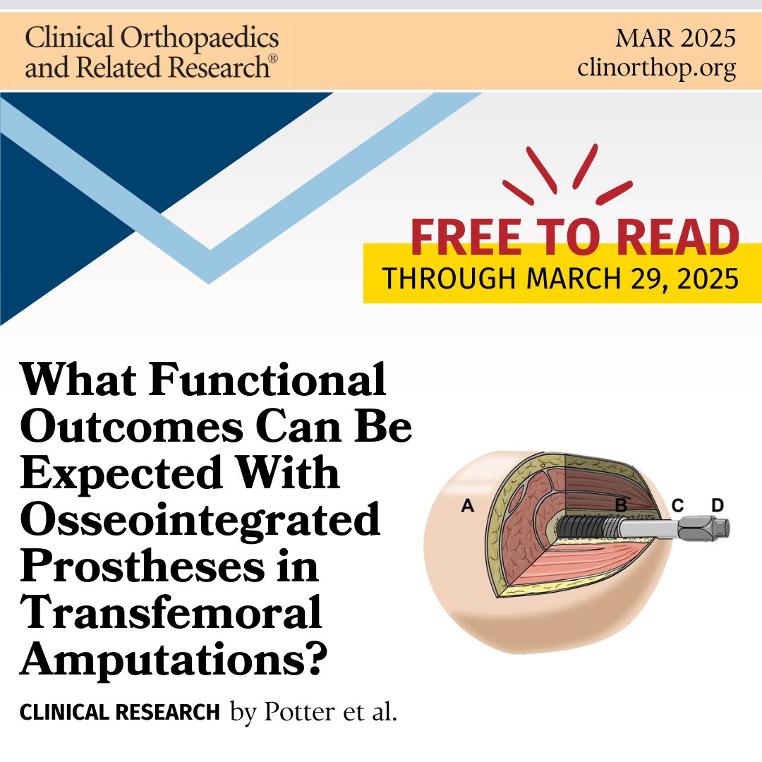 CORR (@clinorthop) on Twitter photo 📢 Free to read until March 29: In #CORR, Potter et al. show the promise of osseointegration surgery after transfemoral amputation and provide a novel MCID forfuture studies.
Read the article here, free for 1 week only: ow.ly/QEYS50VmwV2
#orthoTwitter #medTwitter 📢 Free to read until March 29: In #CORR, Potter et al. show the promise of osseointegration surgery after transfemoral amputation and provide a novel MCID forfuture studies.
Read the article here, free for 1 week only: ow.ly/QEYS50VmwV2
#orthoTwitter #medTwitter