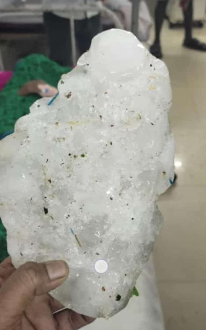 binit_mohanta's tweet photo. Severe hailstorm hits Bisoi block, #Mayurbhanj, causing extensive damage to crops and property. Such extreme weather events are becoming more frequent, highlighting the growing impact of climate change. Urgent need for climate resilience measures. #ClimateChange 
@ForestDeptt https://t.co/LIh0rHDX59