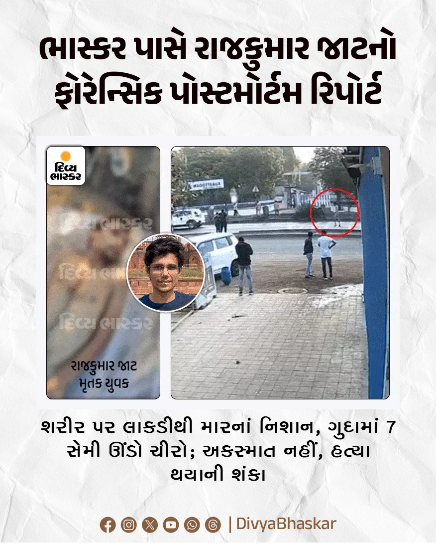 ભાસ્કર પાસે રાજકુમાર જાટનો ફોરેન્સિક પોસ્ટમોર્ટમ રિપોર્ટ : શરીર પર લાકડીથી મારનાં નિશાન, ગુદામાં 7 સેમી ઊંડો ચીરો; અકસ્માત નહીં, હત્યા થયાની શંકા
divya.bhaskar.com/M1k35gzNXRb
#Gondal #Rajkot #Jat #youth #accident #RajkumarJat