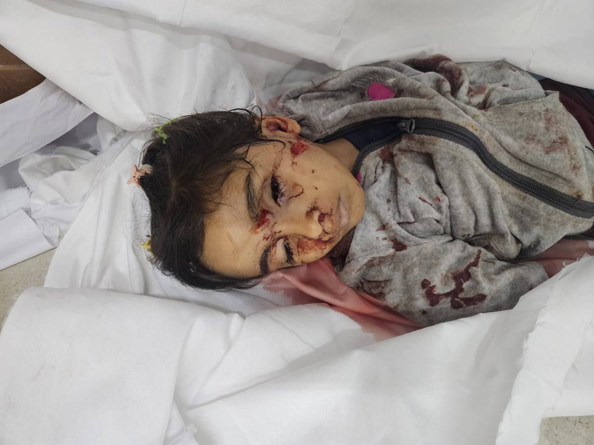 gazanotice's tweet photo. ⚠️Sensitive Content ⚠️

🚨BREAKING: Several child victims have arrived at Nasser Medical Complex in Khan Younis, southern Gaza, due to the intense Israeli airstrikes.