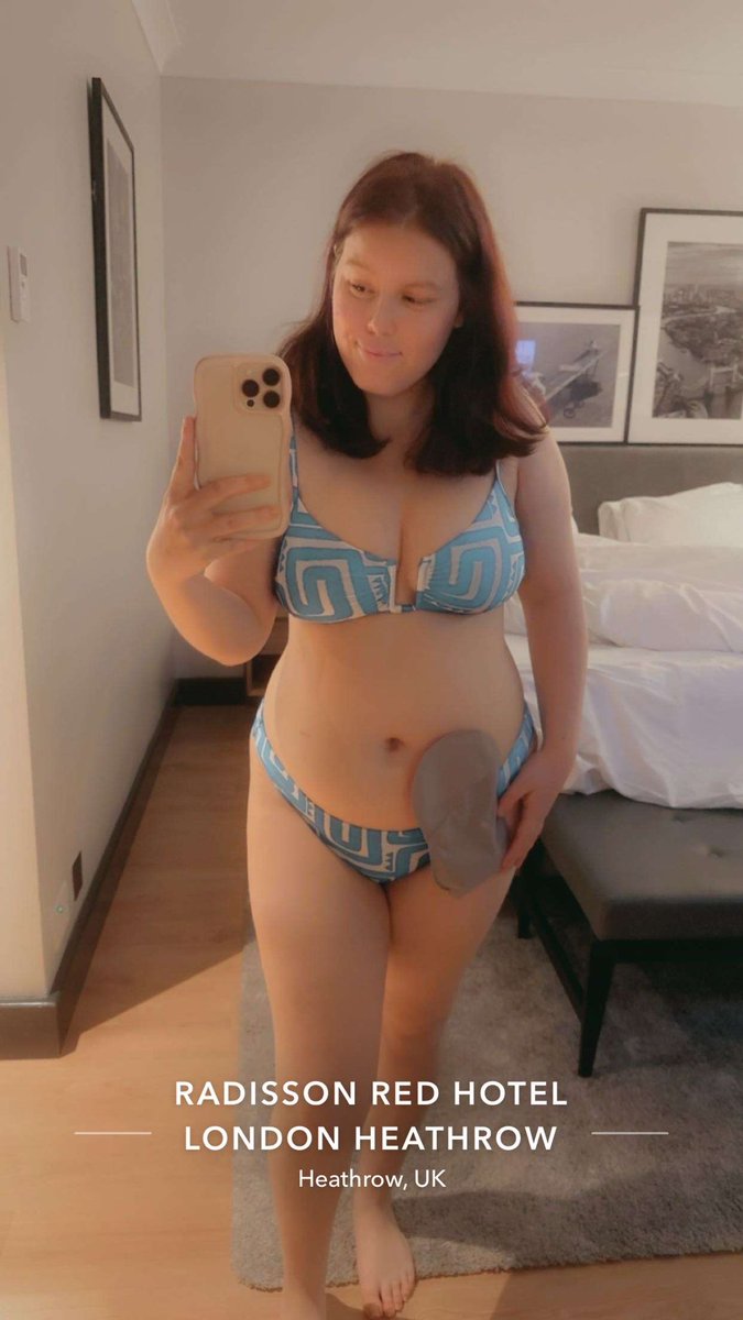 mychronicallyilljourney2.0 (@daniellemusiak) on Twitter photo A short 2 night stay in London last week! Decided to check out the Health & Leisure Centre at my Hotel and I didn’t care one bit if people stared at me! 💪❤️ <a href="/ColostomyUK/">ColostomyUK</a> <a href="/ConvatecStomaUK/">Convatec Stoma UK</a> <a href="/AmcareConvatec/">Amcare by Convatec</a> <a href="/MeetAnOstoMate/">MeetAnOstoMate.org</a> <a href="/iasupport/">IA (Ileostomy and Internal Pouch Association)</a> A short 2 night stay in London last week! Decided to check out the Health & Leisure Centre at my Hotel and I didn’t care one bit if people stared at me! 💪❤️ <a href="/ColostomyUK/">ColostomyUK</a> <a href="/ConvatecStomaUK/">Convatec Stoma UK</a> <a href="/AmcareConvatec/">Amcare by Convatec</a> <a href="/MeetAnOstoMate/">MeetAnOstoMate.org</a> <a href="/iasupport/">IA (Ileostomy and Internal Pouch Association)</a>