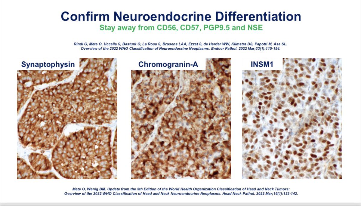 Dr. Mete: beware of using CD56, CD57, PGP 9.5, NSE for confirming neuroendocrine differentiation! <a href="/EndoPath/">Endocrine Pathology</a> <a href="/TheUSCAP/">USCAP</a> #USCAP2025