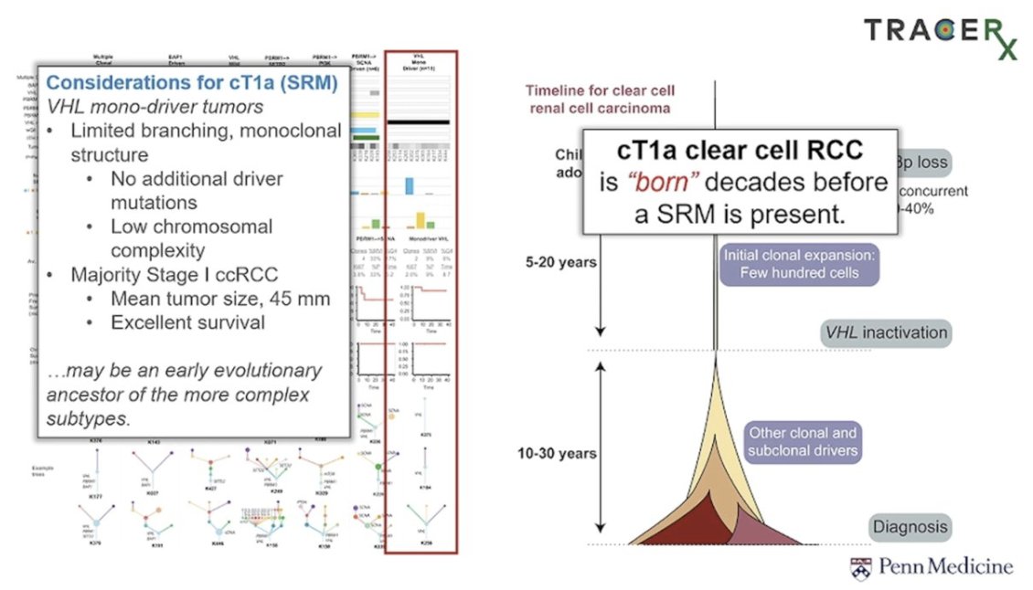UroToday.com (@urotoday) on Twitter photo Risk stratification for a 3 cm small renal mass – à la carte treatment approaches: surveillance, partial nephrectomy, SBRT, and focal ablation. Presentation by <a href="/drphil_urology/">Phillip Pierorazio</a>, <a href="/NNHarke/">Nina Harke</a>, <a href="/_ShankarSiva/">Shankar Siva</a>, and <a href="/Dmitry_Enikeev/">Dmitry Enikeev</a>. #EAU25 written coverage by <a href="/RKSayyid/">Rashid K. Sayyid</a> > Risk stratification for a 3 cm small renal mass – à la carte treatment approaches: surveillance, partial nephrectomy, SBRT, and focal ablation. Presentation by <a href="/drphil_urology/">Phillip Pierorazio</a>, <a href="/NNHarke/">Nina Harke</a>, <a href="/_ShankarSiva/">Shankar Siva</a>, and <a href="/Dmitry_Enikeev/">Dmitry Enikeev</a>. #EAU25 written coverage by <a href="/RKSayyid/">Rashid K. Sayyid</a> >