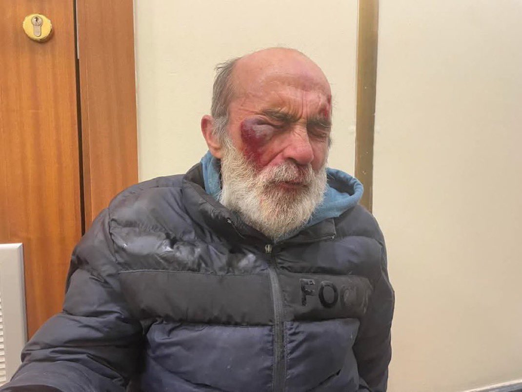 Polise asit atan kişi bu!