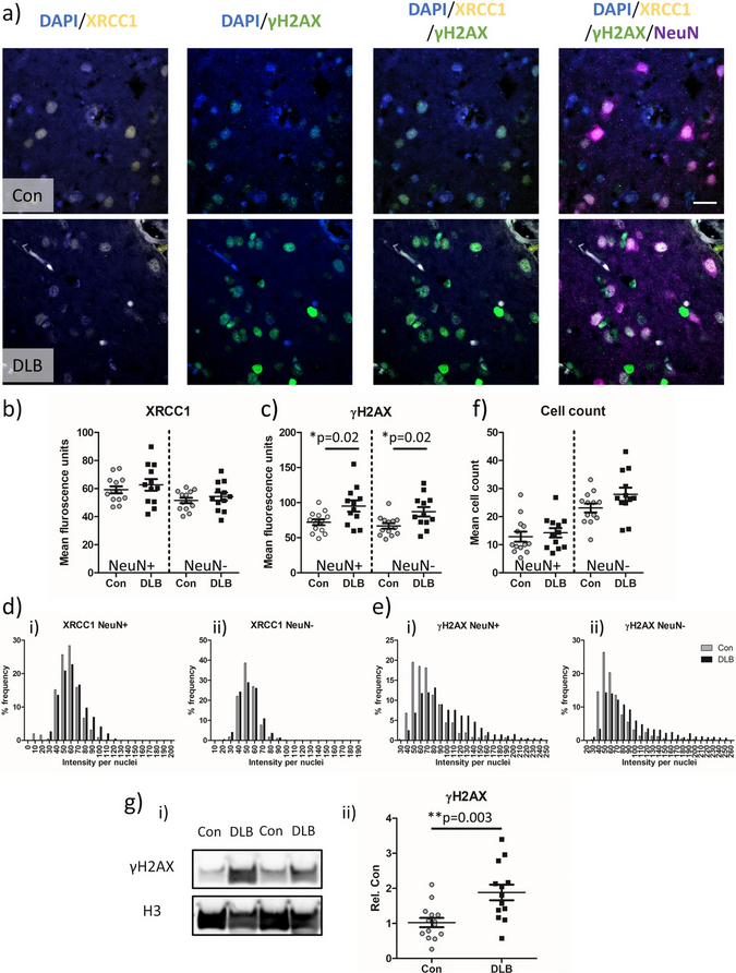 The Science of Parkinson's (@scienceofpd) on Twitter photo New paper from <a href="/touteiro/">Tiago Outeiro</a> et al "supports the hypothesis of a reciprocal relationship between aSyn pathology and nuclear DNA damage & highlights a potential underlying role for DNA damage in pathological mechanisms relevant to dementia with Lewy body"
…arneurodegeneration.biomedcentral.com/articles/10.11… New paper from <a href="/touteiro/">Tiago Outeiro</a> et al "supports the hypothesis of a reciprocal relationship between aSyn pathology and nuclear DNA damage & highlights a potential underlying role for DNA damage in pathological mechanisms relevant to dementia with Lewy body"
…arneurodegeneration.biomedcentral.com/articles/10.11…