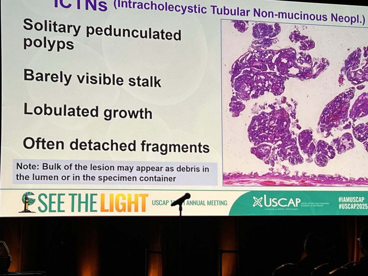 Mvgs1706's tweet photo. Dr. Pehlivanoglu on ICTNs of gallbladder! #PBPS #USCAP25 https://t.co/TetWuSrUTX