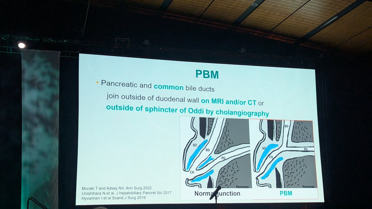 navale_pooja's tweet photo. Dr. Hong unravels malignancies associated with pancreaticobiliary maljunction at the #PBPS companion society @uscap https://t.co/ydoeVxWhDF