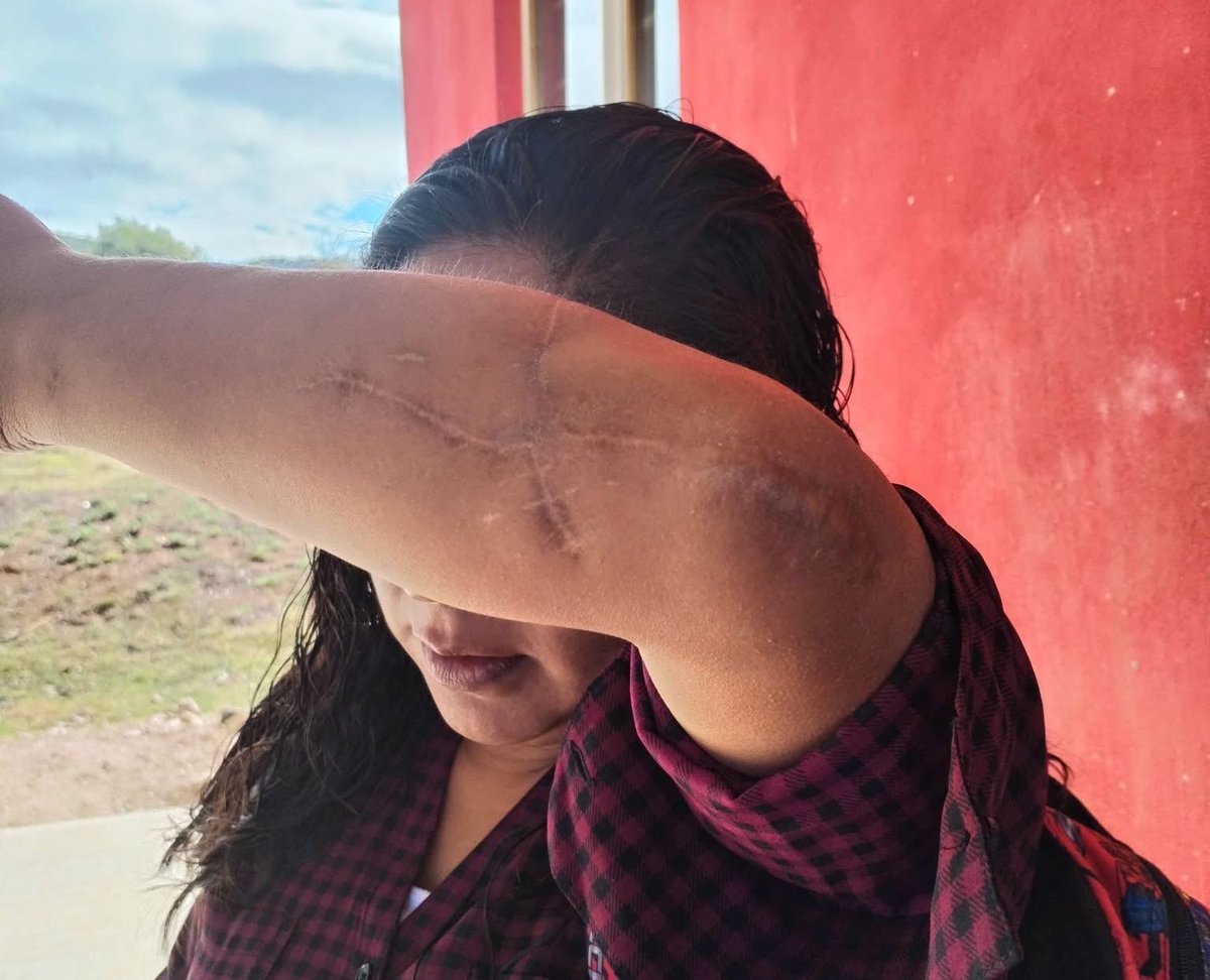 Guille_lopezJi's tweet image. El juez de #Tlaxiaco, Jaziel Vásquez absolvió a mi agresor del delito de tentativa de homicidio calificado, dice son solo lesiones y con ello liberará a mi agresor, yo estuve a punto de morir pero eso poco importa.
¿Cuál perspectiva de género?
¿Cuál justicia para la mujer?