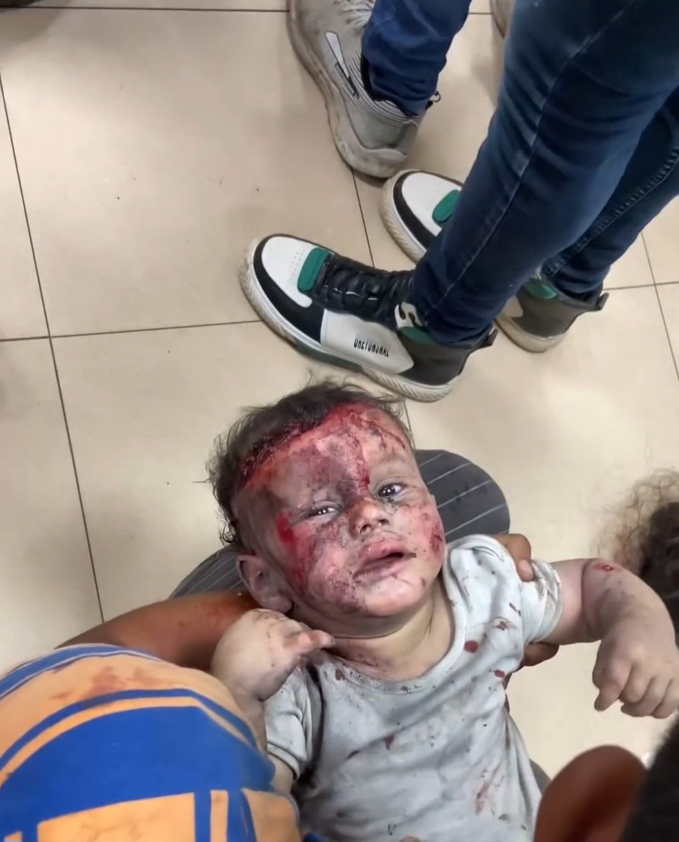 nowgnna's tweet photo. هل جربتم لحظة الفطور اليوم؟
 تلك اللحظات التي تجمع العائلة حول المائدة، حيث يملأ الأذان الأجواء بالسكينة.
 في غزة، كان الفطور شيئًا آخر. كانت الأرض تغلي بالدماء، وكان الصوت الوحيد الذي يملأ الأفق هو صوت الانفجارات.
 العائلات كانت تتجمع حول مائدتها، لكن القذائف لم تميز بينهم https://t.co/rCtXDye3ky