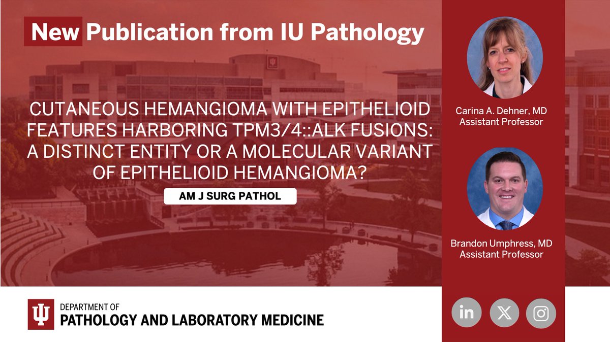 IUPathology (@iupathology) on Twitter photo 🚨 New Publication Alert! 🚨
A report 5 cases with similar morphologic and molecular traits, providing new insights into this unusual vascular neoplasm #dermpath #BSTpath #pathX <a href="/carina_dehner/">Carina Dehner, MD PhD</a> <a href="/BUmphressMD/">Brandon Umphress, MD</a> <a href="/AJSPjournal/">Surgical Pathology</a>
🔗 journals.lww.com/ajsp/abstract/… 🚨 New Publication Alert! 🚨
A report 5 cases with similar morphologic and molecular traits, providing new insights into this unusual vascular neoplasm #dermpath #BSTpath #pathX <a href="/carina_dehner/">Carina Dehner, MD PhD</a> <a href="/BUmphressMD/">Brandon Umphress, MD</a> <a href="/AJSPjournal/">Surgical Pathology</a>
🔗 journals.lww.com/ajsp/abstract/…