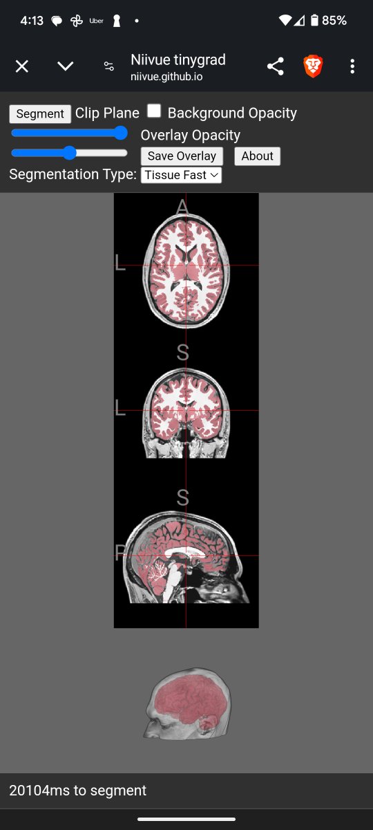 🚀 Breakthrough in mobile neuroimaging!
Thanks to <a href="/wpmed92/">Ahmed Harmouche</a>, brainchop.org will soon run *full brain* volumetric segmentation on your phone.

🔬Preview: niivue.github.io/niivue-tinygra…
(WebGPU browser required)

Meanwhile, check out brainchop.org!
#Neuroimaging #WebGPU