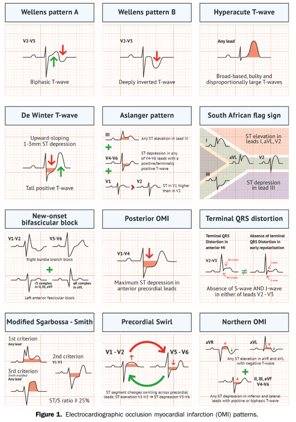 CharlyParCoeur tweet media