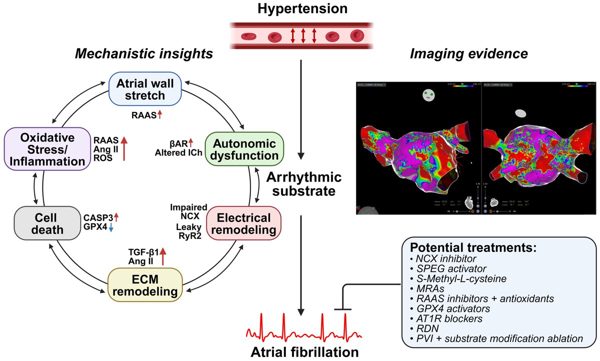 Journal of Cardiovascular Electrophysiology (@jcardioep) on Twitter photo 📌Checkout in <a href="/JCardioEP/">Journal of Cardiovascular Electrophysiology</a>
🎓 "Hypertension and Atrial Fibrillation: Insight From Basic to Translational Science Into the Mechanisms and Management" by <a href="/Kantharia_EP/">Bharat K. Kantharia, MD, FRCP, FESC</a> , <a href="/ShuaiZh17/">Shuai Zhao</a> , <a href="/Dominik_Linz/">Dominik Linz</a> , <a href="/JordiHeijman/">Jordi Heijman</a> , <a href="/XWehrens/">Xander Wehrens</a>
onlinelibrary.wiley.com/doi/10.1111/jc… 📌Checkout in <a href="/JCardioEP/">Journal of Cardiovascular Electrophysiology</a>
🎓 "Hypertension and Atrial Fibrillation: Insight From Basic to Translational Science Into the Mechanisms and Management" by <a href="/Kantharia_EP/">Bharat K. Kantharia, MD, FRCP, FESC</a> , <a href="/ShuaiZh17/">Shuai Zhao</a> , <a href="/Dominik_Linz/">Dominik Linz</a> , <a href="/JordiHeijman/">Jordi Heijman</a> , <a href="/XWehrens/">Xander Wehrens</a>
onlinelibrary.wiley.com/doi/10.1111/jc…