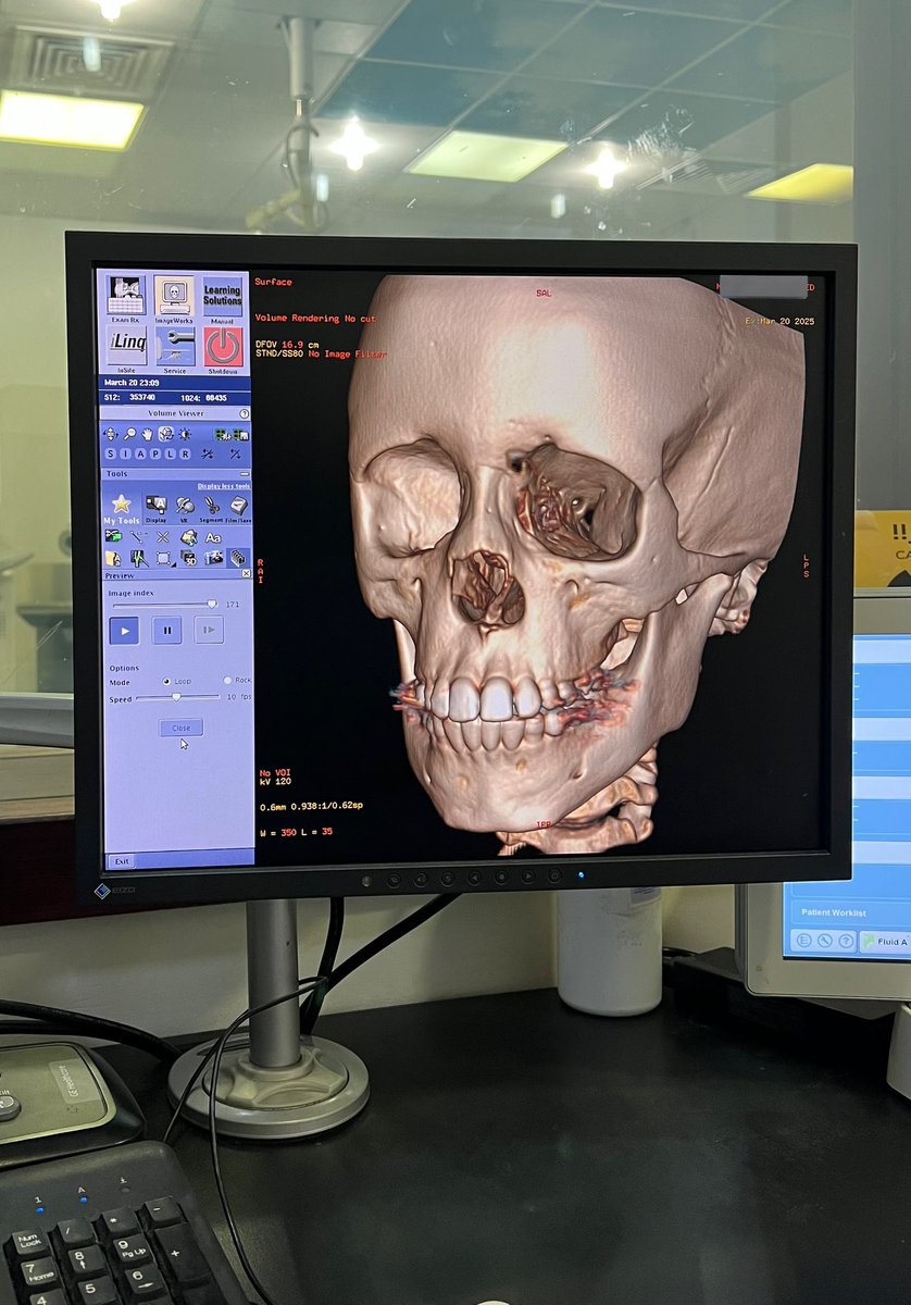 sllrx2's tweet photo. CT SCAN MONTH 🚨🌙. https://t.co/IOmOqnV3OK