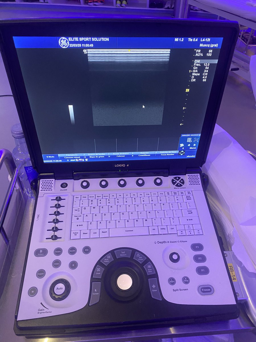 Finalizado el Curso de Ecografia músculo-esquelética en lesiones del miembro inferior y técnicas invasivas.
Agradecidos a la Dra.Ana de Groot y  <a href="/primfisio/">PRIM Physio</a> por las facilidades, y sobre todo, al <a href="/RCCelta/">Celta</a> por respaldar nuestra propuesta formativa interna.