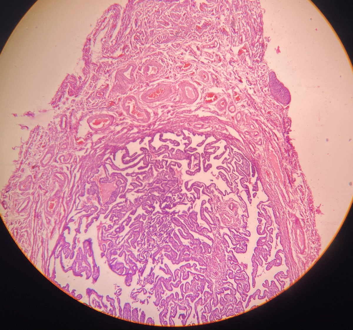 MunchManju95's tweet photo. What is the normal structure seen here and ??
#FGT
#pathresidency
#normalvsabnormal https://t.co/ebLlDWWa5X