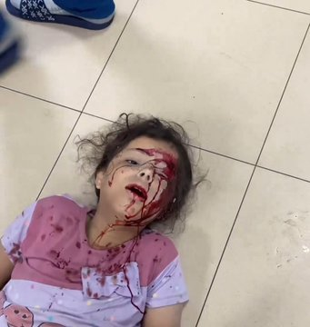 mshinqiti's tweet photo. This is the brutal reality of children suffering under #Israel and its American backers in the #Gaza_Concentration_Camp. Innocence crushed, lives stolen—how much longer will the world stay silent? https://t.co/5sBzey8Iai