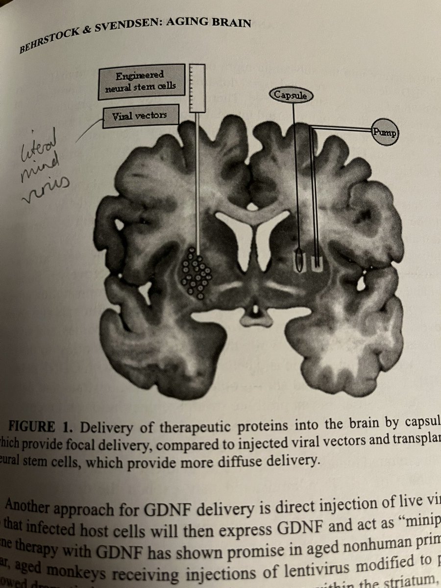 thomjenko's tweet image. Just read that scientists have developed literal mind-viruses, which improve dopamine storage and reverse age-related motor function impairment.

This is from Behrstock and Svendsen 2004. So I’m a little behind the state of the art but still 🤯