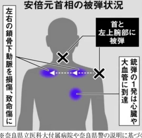 GobonotoJP's tweet photo. ちょっとこれ色々と怖いので余り触れたくなかったのですが

4月1日まで時間が無いので

安倍晋三元総理暗殺事件について初めて書きます

あれだけの事件が3年目に入るのに初公判すら行われません

もちろん犯人が山上じゃないからです

のっけから矛盾点が多すぎて公判の維持が出来るのでしょうか？

2月27日の記者会見で米国FBIパテル長官が

安倍晋三元総理暗殺事件について言及しました

安倍晋三元総理が殺された理由について

□世界経済フォーラム(ダボス会議)の決定に従わなかったから

□コロナワクチンを義務化しなかったから

□コロナワクチン160万本を送り返したから

□国民にイベルメクチンを配布しようとしたから

であると米国FBI長官が公の場で語ったのです

FBI長官が言及するとは凄いです

現に2020年4月7日の記者会見で安倍晋三総理は

「イベルメクチンについては臨床や治験を進めており、この感染症への有効性が確認され次第、早期の薬事承認を目指す考えです」

と公に発言してるのですが、なんと

「新型コロナウイルス感染症に関する安倍内閣総理大臣記者会見」

で検索すると首相官邸の動画では見事にイベルメクチンの下りがカットされているのです

安倍総理は失言した訳ではありません

「コロナウイルスへの有効性が確認されたら早期薬事承認を目指す」と当たり前の事を言っただけです

日本政府やってくれます

確信犯です

わざとあえて真実を隠蔽しているのです

日本人が開発したイベルメクチンで効果がある事を知られたくなかった誰かの思惑で

日本政府は真実を隠蔽しました

日本政府にカットされる前の安倍総理の貴重な発言動画を貼っておきます

首相官邸サイトの動画と見比べて下さい

日本政府が安倍晋三総理の方針を意図的にカットした動かぬ証拠です

実際に治る薬の存在を知られたくない者が日本政府に働きかけました

2020年5月の段階で北里大学の大村智先生(ノーベル賞受賞)の研究チームは

「イベルメクチンでコロナウイルスを72時間で封じ込めた」と記者会見しましたが

日本政府が薬事承認する事は無く

安倍総理は2020年8月に謎の腸の病気が再発して入院し9月16日に退陣となったのです

橋本龍太郎総理が亡くなった時と同じ病気です

そして次に現れたのがワクチン菅(すが)です

モデルナ金属片問題で混入していた金属片の調査結果よりも前に

「体制に支障は御座いません」と夜中の3時に記者会見して

翌日からもワクチンを打ち続けた菅義偉(すがよしひで)内閣総理大臣です

皆、河野太郎のことを悪く言いますが、河野太郎は大臣を5回歴任した麻生派の重鎮です

その重鎮がワクチン担当大臣をやらされて「一日100万人に打て」と命じたのは菅義偉です

小学生でも分かります

山崎パンに金属片が見つかって問題になって社長が記者会見を開いて

同じレーンで作った163万個を回収して

「明日からもセブンイレブンで売り続けます」は無いです

何が何でも日本人にワクチンを打たせたい何者かの意図があり

その意図に抗った安倍晋三総理は消された

そう米国FBI長官は発言しました

このFBI長官の発言を一切報じない日本メディアの奇妙さを奇妙と思わない人が奇妙です

洗脳とは気付かないから洗脳なのでしょう

始まりは7月6日の文春の記事でした

7月8日に長野県での応援演説が決まっていた安倍総理は

候補者のスキャンダル(文春砲)により急きょ前日に奈良県に入る事が決まります

何かの大きな事件のきっかけは必ず文春が口火を切ります

奈良県の佐藤啓候補の戦況が良くないとの事で10日間で二度目の応援演説でした

一度目は人通りが多い北口で

二度目はなぜか南口でミカン箱の上で演説です

各社メディアは三つ巴の戦いで佐藤啓が危ないと報じました

結果は２位に7万票の差を付けて３位に15万票以上の差を付けた圧勝でした

三つ巴の意味を知ってますか？

佐藤啓のどこがピンチなのですか？

この事件の解決の糸口の全ては奈良県立医科大学の福島英賢(ふくしまひでただ)先生の記者会見に集約されます

12時20分に安倍総理が搬送されて17時3分に死亡断定するまで懸命に処置を施し

すぐさま18時過ぎから記者会見に応じた福島英賢先生の発言内容です

同じ質問を何度も繰り返す各社の頭の悪い記者の質問に曖昧な回答を一切しなかった福島先生の答弁は信用に値します

例えば「現場に居合わせた看護師が行ったAEDや心臓マッサージは適切であったか？」の質問には

「分かりません」

2発の弾丸のどちらかが致命傷になったのか？

「分かりません」

「安倍さんのお顔の表情は苦しそうなのか？安らかなのか？」のような馬鹿な質問にも

「お顔を拝見する時間はありませんでした」

「現場で即死の理解で良いですか？」の質問にも

「現場で心肺停止状態になったと言う表現になるかと思います」と言い直されます

記者とのやり取りの中で推論や憶測で語らないお人柄が伺い知れます

その福島英賢先生が明確に断言している事が何点かあるのです

□まず弾の射入孔(弾丸が体に入った穴)は体の前面であり鎖骨より上の首に2カ所(距離5センチ)

□そして射出孔(弾丸が体から出た穴)は左肩に一箇所

□射入孔と射出孔の違いは射入孔は小さく射出孔は弾が体内で衝撃で変形するので大きくなる

□弾は見つかってないが一発は射出孔から体外へ放出されたと思われる

これが処置をされた直後の記者会見での福島英賢先生による見解であり

処置には20人以上の医療従事者が立ち会っていました

説明するまでもないですが自家製のおもちゃのピストルで撃ったとされる山上容疑者は

安倍元総理の背後から発砲しました

一回目の銃声で安倍元総理は山上に背を向けたまま

時計の針と反対方向に左旋回で振り返ろうとして安倍元総理は地面に倒れます

ワンチャン振り返ろうとした時に被弾したとしても安倍元総理は左旋回しているので

弾は左から進入して右肩に抜けるはずです

山上が後方から放った弾が安倍元総理の首前面に被弾して左肩から射出するのはあり得ないのです

山上が優秀な弁護士を付けて証人に福島英賢先生が呼ばれたなら

検察はどのように反証するのでしょうか？

ケネディ暗殺事件で単独犯とされたオズワルドのように山上は拘留中に殺されるのでしょうか？

福島先生は言及してませんが鎖骨より上の首に射入孔があって弾が肩から射出されたのであれば

安倍元総理は頭上から狙撃された事になります

当たり前の話ですがミカン箱の上に乗った安倍元総理を地面から狙撃したなら

首から射入した弾は首から上方へ射出するはずです

首より上にボディが無いので弾は肩から射出されません

そして数日後に行われた奈良県警の記者会見が気持ち悪いです

「被弾した傷は首と左上腕の少なくとも2カ所で、司法解剖の結果、死因は左上腕から入った銃弾で左右の鎖骨下にある動脈を損傷したことによる失血死である」

産経新聞にはご丁寧に矢印付きでイラストも掲載されました(堂々と嘘を付く産経新聞のイラスト貼っておきます)

福島先生の説明の真逆です

安倍元総理の背後から撃った山上の弾が当たった事にする為には

左肩の射出孔を射入孔にして左肩から弾が入った事にする以外は無いのです

安倍元総理の処置には20人以上の医療従事者が立ち会っているのです

射入孔と射出孔の違いくらいプロが見たなら一目瞭然です

弾が飛んできた方向も全くの真逆なので

福島先生が嘘を付いてるか？警察とメディアが嘘を付いているか？

どちらか一方が必ず嘘を付いているのです

こんな中学生でも高校生でも簡単に論破出来てしまうような内容で検察は公判を維持出来るのでしょうか？

警察が堂々と嘘の発表をしてメディアは嘘の発表を疑う事なくそのまま伝えるだけ

真実を伝えられないメディアで何の為に働いているのですか？

山上が犯人じゃないと知りながら山上を犯人に仕立てあげる茶番を演じる検察で働く方々

どんな気分ですか？

これだけ国民に愛された国のリーダーが暗殺されたのにテロリストの肩を持つのですか？

怖いから首を突っ込まないのですか？

真実を追求出来ないなら真相を明らかにする勇気が無いなら

警察を辞めて下さい

検察を辞職して下さいよ？

真犯人やテロリストの肩を持つ警察や検察で働くことに何の意味があるのですか？

どうして悪に手を貸すのですか？

人としての誇りは無いのですか？

上司に言われたからですか？

保身ですか？

もう一度言います

日本人としての誇りは無いのですか？

滞在先のホテルの住所で運転免許証を取得出来る外国人

ジュネーブ条約に加盟してない中国では国際免許証が持てない為

滞在先の日本のホテルの住所で日本の免許証を取得します

試験は10問中7問正解で合格です

これで晴れて日本の免許証を取得した中国人は100カ国以上で運転出来るようになります

その為に中国人が日本の試験場に殺到しています

10問中7問正解で合格て(笑)

誰が考えてもおかしい事だらけ

それでも自民党に投票するのですね？

真実を発信した人は陰謀論者なのですか？

明らかにおかしいと知りながら自民党に投票するのですか？

創価学会の皆さんは皆で第九を歌って自民党を応援するのですか？

DSサイド(テロリスト)の要求をはねのけて国民の命を守ろうとして殺された総理大臣

それなのに警察も検察も守ってくれない

こんな国、、嫌ですよ。。

奥野卓志