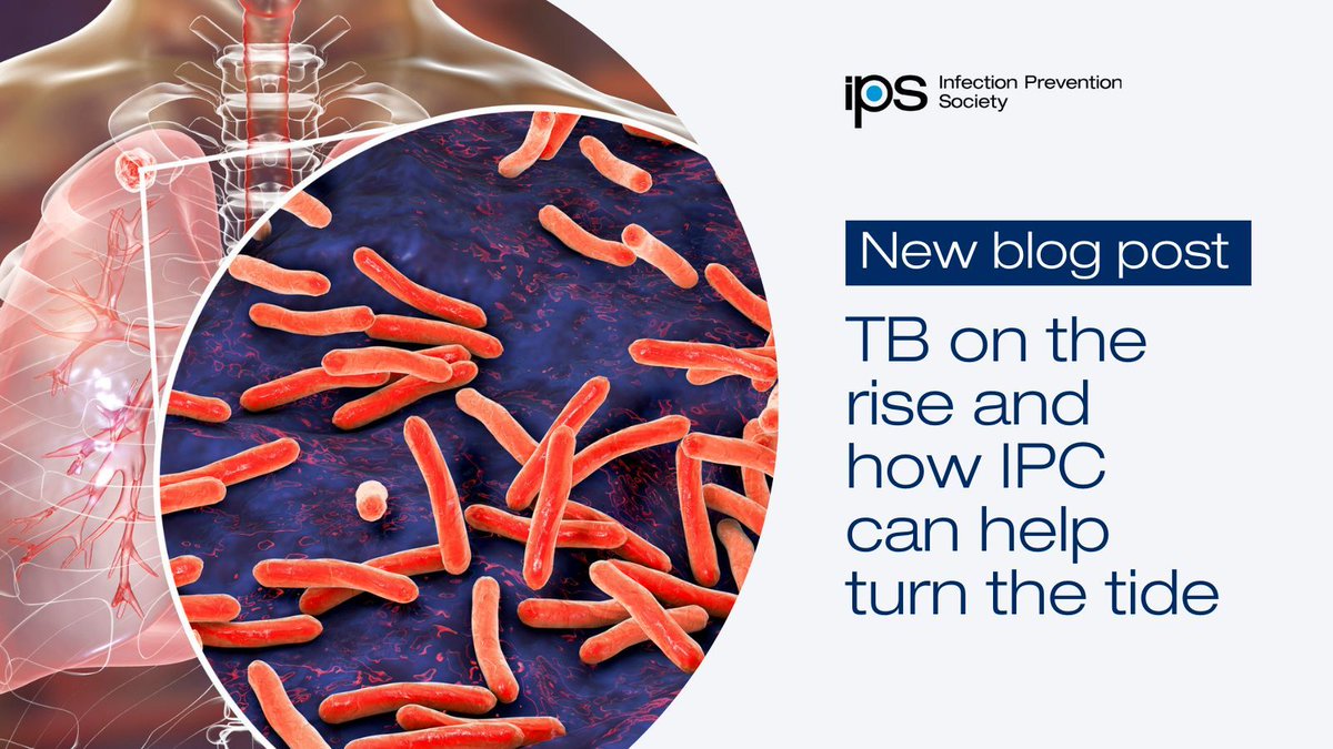 IPS (@ips_infection) on Twitter photo TB cases are rising in the UK, affecting patients and healthcare workers. This #WorldTBDay, learn how IPC teams play a key role in prevention and early diagnosis. Read our guest blog by <a href="/EstherTaborn/">Esther Taborn</a> & Tracey Langham. ips.uk.net/post/news/tb-o… TB cases are rising in the UK, affecting patients and healthcare workers. This #WorldTBDay, learn how IPC teams play a key role in prevention and early diagnosis. Read our guest blog by <a href="/EstherTaborn/">Esther Taborn</a> & Tracey Langham. ips.uk.net/post/news/tb-o…