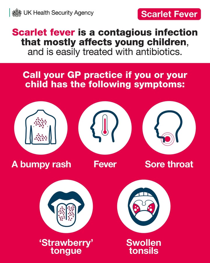Scarlet fever can be serious if left untreated.

It's highly contagious and mostly affects young children. 

If you think you or your child has symptoms, contact your GP practice.

More info: nhs.uk/conditions/sca…
