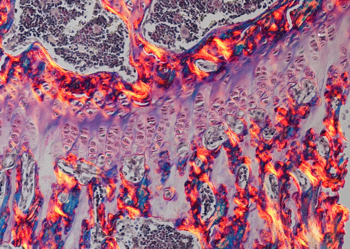 CRUKresearch's tweet image. We had too many to choose from in last month’s round of #ResearchIsBeautiful entries, so here’s a roundup of the ones that came out best of the rest!🔗bit.ly/41T021H
Don’t forget - there’s just one day left to submit for the March round. We want to see anything that…
