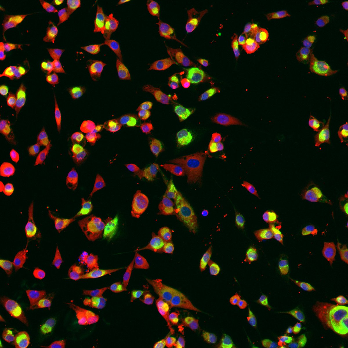 CRUKresearch's tweet image. We had too many to choose from in last month’s round of #ResearchIsBeautiful entries, so here’s a roundup of the ones that came out best of the rest!🔗bit.ly/41T021H
Don’t forget - there’s just one day left to submit for the March round. We want to see anything that…