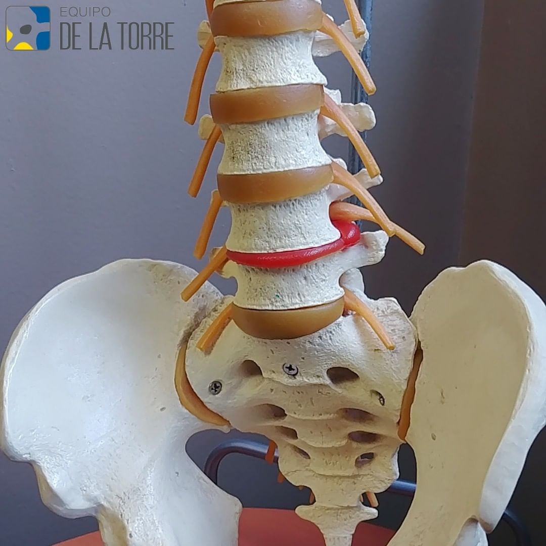 📌 ¿Sabías que la mayoría de los adultos mayores de 40 años tienen al menos una protusión discal sin presentar síntomas?

✅ Se trata de una lesión degenerativa común en la que el núcleo pulposo se desplaza de su posición habitual.

 ➡ neurocirugiaequipodelatorre.es/lesiones-de-es…
 #protusióndiscal