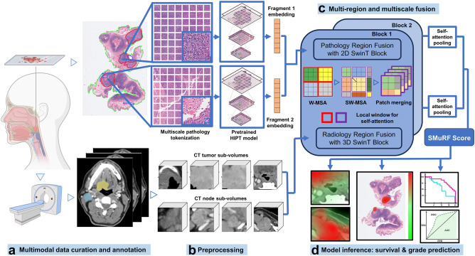 Anant Madabhushi (@anantm) on Twitter photo In <a href="/eBioMedicine/">eBioMedicine – The Lancet Discovery Science</a> we present SMuRF, a Swin Transformer-based model for fusing CT & HE slides to predict survival & tumor grade in HPV-associated OPSCC.
🔹 81% accuracy in survival prediction
🔹 Outperforms single-modality models (AUC = 0.75)📖 Read more at tinyurl.com/35ch4kn7 In <a href="/eBioMedicine/">eBioMedicine – The Lancet Discovery Science</a> we present SMuRF, a Swin Transformer-based model for fusing CT & HE slides to predict survival & tumor grade in HPV-associated OPSCC.
🔹 81% accuracy in survival prediction
🔹 Outperforms single-modality models (AUC = 0.75)📖 Read more at tinyurl.com/35ch4kn7