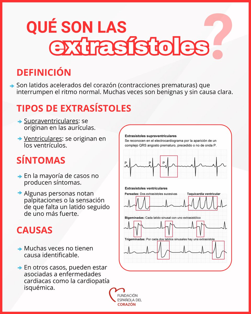🔴Algunas personas describen las #extrasístoles como latidos más fuertes o cambios de ritmo. Otras, ni siquiera las notan.

➡️se detectan por casualidad en un electrocardiograma, y en muchos casos son inofensivas, especialmente si el corazón está sano.
🚨Pero cuando se repiten