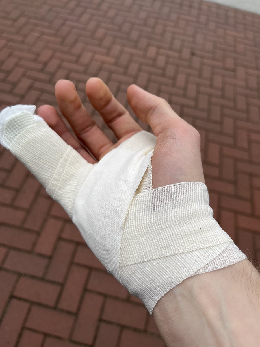 1:0 für die scheiss Absperrung