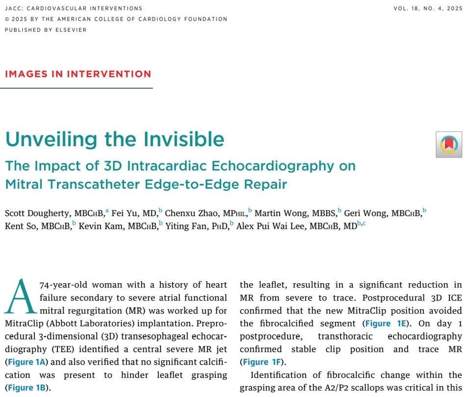 Alex LEE (@alexlee_md) on Twitter photo 4D ICE reports x2 published online in JACC Intervention and Circulation Imaging in 6m! Congratulations, Dr. Yu and Dr. Dougherty! <a href="/EchofirstB/">Echofirst Bot</a> <a href="/CircImaging/">CircImaging</a> <a href="/JACCJournals/">JACC Journals</a> 4D ICE reports x2 published online in JACC Intervention and Circulation Imaging in 6m! Congratulations, Dr. Yu and Dr. Dougherty! <a href="/EchofirstB/">Echofirst Bot</a> <a href="/CircImaging/">CircImaging</a> <a href="/JACCJournals/">JACC Journals</a>