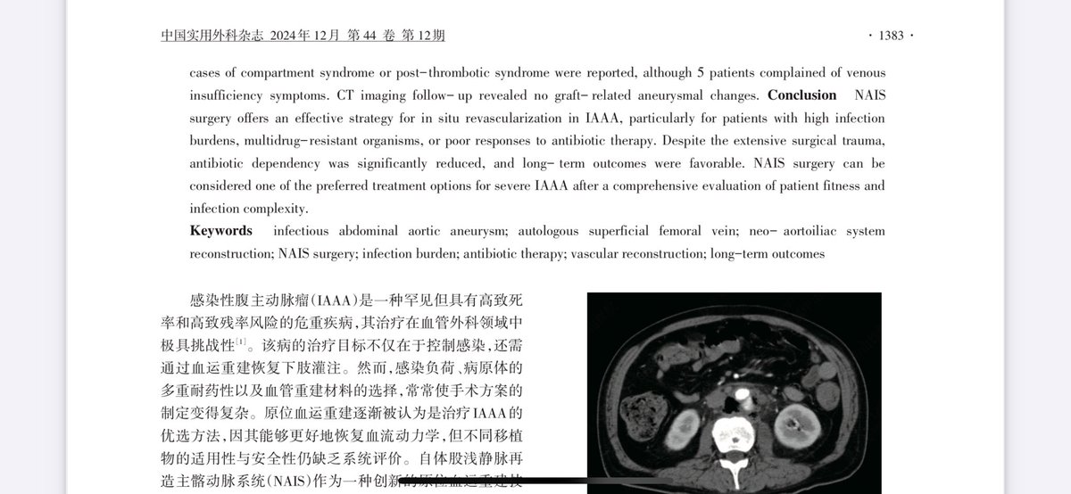 Jianing Yue_Vas Surg in Shanghai tweet media
