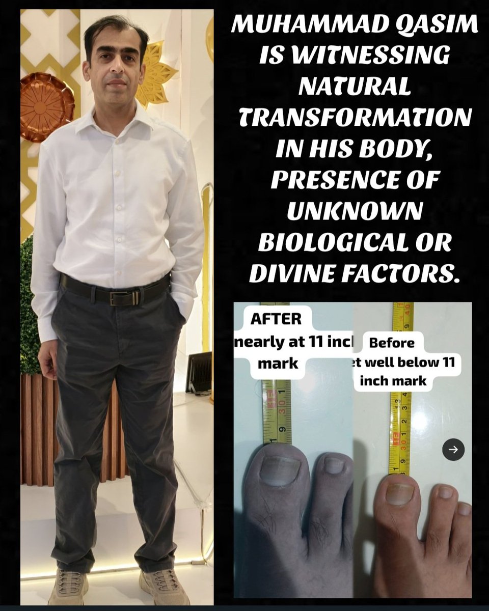 alma_ida124's tweet photo. For @elonmusk pay attention to Muhammad Qasim's dream, please do research, Muhammad Qasim experienced an increase in the length of his legs at the age of 49 and this is a rare phenomenon that only occurs in Muhammad Qasim
 #LookAtQasimElon 
#ElonMusk 
#MuhammadQasim 
@elonmusk https://t.co/56GKp6tHdH