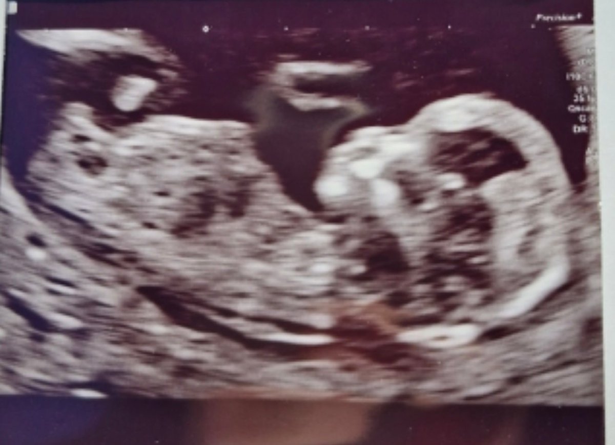 Shelli Diids 🖐 tweet media