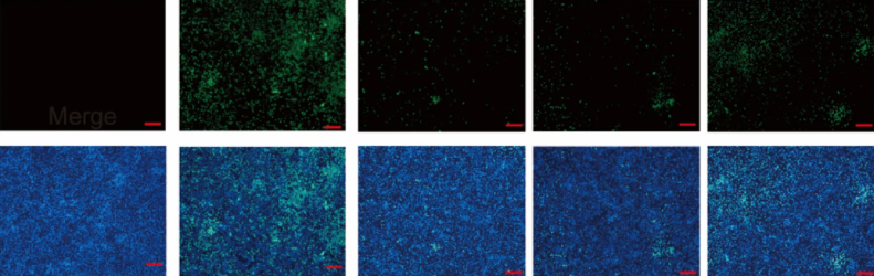 Immunology of Infectious Disease News (@infdisease_news) on Twitter photo ๐ท This study highlights the promising anti-Influenza A virus properties of cilnidipine both in vitro and in vivo, suggesting its potential as a clinical agent for emergencies against #influenza outbreaks.
<a href="/BMCMedicine/">BMC Medicine</a> | bit.ly/4ip5Y93 ๐ท This study highlights the promising anti-Influenza A virus properties of cilnidipine both in vitro and in vivo, suggesting its potential as a clinical agent for emergencies against #influenza outbreaks.
<a href="/BMCMedicine/">BMC Medicine</a> | bit.ly/4ip5Y93
