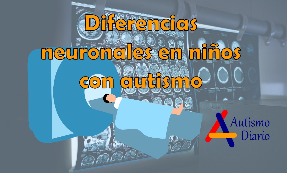 Diferencias neuronales en niños con autismo 
Una investigación descubre diferencias neuronales en los niños con autismo. Las mediciones neuronales pueden proporcionar nuevos conocimientos sobre el diagnóstico y las intervenciones terapéuticas para el wp.me/p1lUm3-blg