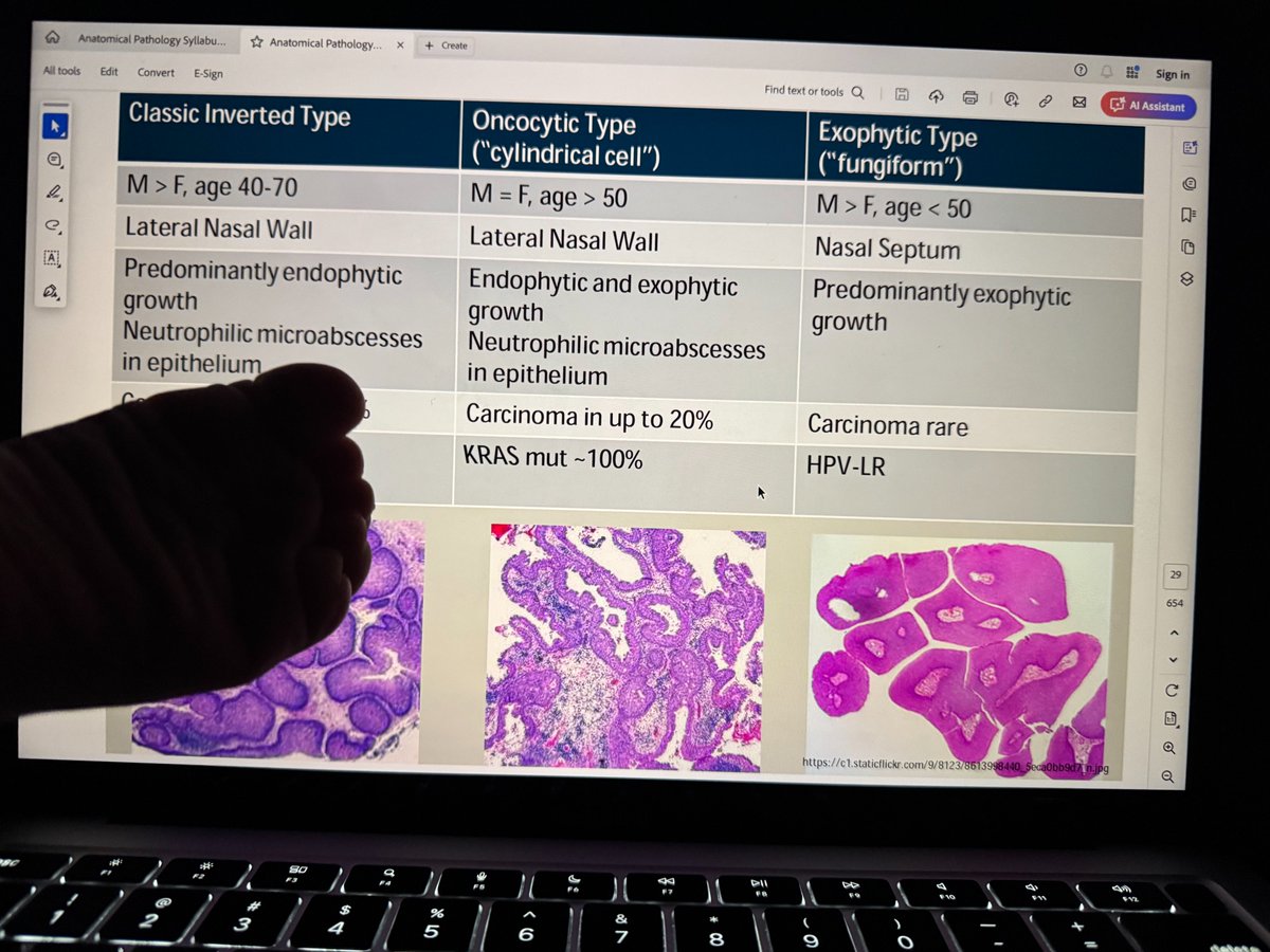 Just my laptop and some tiny baby feet stealing the spotlight, making sure I don't get too focused on studying for the Pathology Boards! 😅👣
#MomLife #Pathology